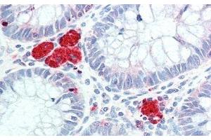 Detection of HEXb in Human Colon Tissue using Polyclonal Antibody to Hexosaminidase B Beta (HEXb)