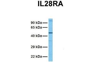 Western Blotting (WB) image for anti-Interleukin 28 Receptor, alpha (Interferon, lambda Receptor) (IL28RA) (N-Term) antibody (ABIN2783214)