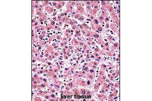 AL Antibody (Center) (ABIN657476 and ABIN2846504) immunohistochemistry analysis in formalin fixed and paraffin embedded human liver tissue followed by peroxidase conjugation of the secondary antibody and DAB staining. (PLAP Antikörper  (AA 282-309))