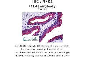 Image no. 1 for anti-Natriuretic Peptide Receptor B/guanylate Cyclase B (Atrionatriuretic Peptide Receptor B) (NPR2) (AA 131-231) antibody (ABIN1723733) (NPR2 Antikörper  (AA 131-231))