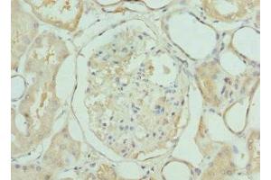 Immunohistochemistry of paraffin-embedded human kidney tissue using ABIN7158340 at dilution of 1:100 (LIMS1 Antikörper  (AA 1-325))