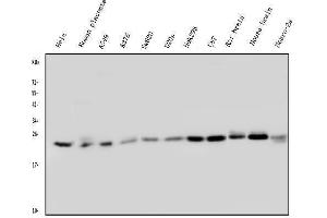 Western blot analysis of Rab5/RAB5A using anti-Rab5/RAB5A antibody (ABIN6719366).