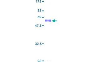 Image no. 1 for Hepatic Leukemia Factor (HLF) (AA 1-295) protein (GST tag) (ABIN1306773) (HLF Protein (AA 1-295) (GST tag))