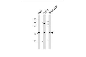 All lanes : Anti-GPX7 Antibody (Center) at 1:2000 dilution Lane 1: Hela whole cell lysate Lane 2: THP-1 whole cell lysate Lane 3: RI 8226 whole cell lysate Lysates/proteins at 20 μg per lane. (Glutathione Peroxidase 7 Antikörper  (AA 73-107))