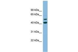 Image no. 1 for anti-Ankyrin Repeat and MYND Domain Containing 2 (ANKMY2) (N-Term) antibody (ABIN6744186) (ANKMY2 Antikörper  (N-Term))