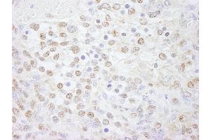 Immunohistochemistry (IHC) image for anti-Polymerase (DNA Directed), lambda (POLL) (AA 525-575) antibody (ABIN7448731) (POLL Antikörper  (AA 525-575))