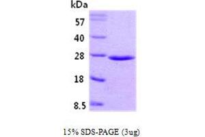 SDS-PAGE (SDS) image for RAB5A, Member RAS Oncogene Family (RAB5A) (AA 1-215) protein (ABIN666700)