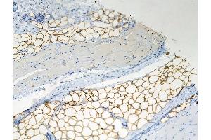 Phospho-Perilipin-1 (Ser522) Antibody at 1/100 staining Rat skin tissue by IHC-P.