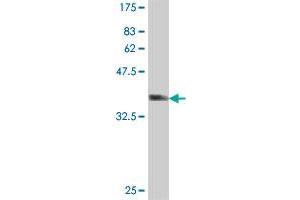 Western Blot detection against Immunogen (37. (Reticulon 2 Antikörper  (AA 1-100))