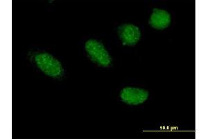 Immunofluorescence of purified MaxPab antibody to GRHL2 on HeLa cell. (GRHL2 Antikörper  (AA 1-625))