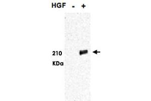 Western blot using MET (phospho Y1349/1356) polyclonal antibody  shows detection of phosphorylated MET. (c-MET Antikörper  (pTyr1349, pTyr1356))