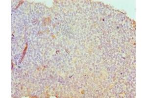 Immunohistochemistry of paraffin-embedded human tonsil tissue using ABIN7171193 at dilution of 1:100 (Syndecan 1 Antikörper  (AA 25-240))