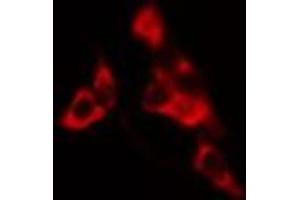 ABIN6275216 staining HuvEc cells by IF/ICC. (LSP1 Antikörper  (C-Term))