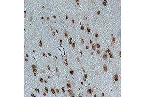 Immunohistochemical analysis of CACNG4 staining in rat brain formalin fixed paraffin embedded tissue section.