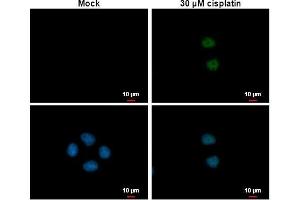 ICC/IF Image p21 Cip1 antibody detects p21 Cip1 protein at nucleus by immunofluorescent analysis.