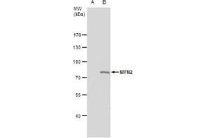 WB Image MFN2 antibody [N1N2], N-term detects MFN2 protein by western blot analysis.