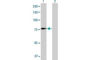 Mahogunin RING Finger Protein 1 Antikörper  (AA 1-576)