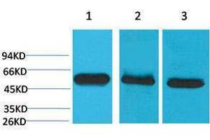 Western Blotting (WB) image for anti-Caspase 8 (CASP8) antibody (ABIN3181527) (Caspase 8 Antikörper)