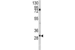 Western blot analysis of SLUG antibody and A2058 lysate. (SLUG Antikörper  (AA 1-30))