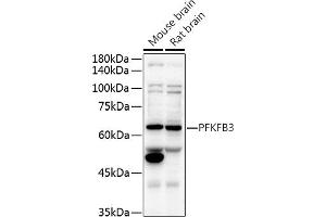 Western blot analysis of extracts of various cell lines, using PFKFB3 antibody (ABIN6129841, ABIN6145485, ABIN6145487 and ABIN6222692) at 1:500 dilution. (PFKFB3 Antikörper  (AA 400-500))