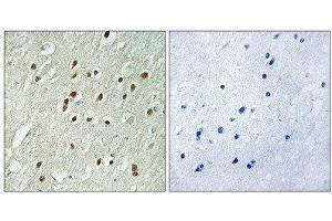 Immunohistochemistry (IHC) image for anti-Centrobin, Centrosomal BRCA2 Interacting Protein (CNTROB) (Internal Region) antibody (ABIN1851052) (CNTROB Antikörper  (Internal Region))