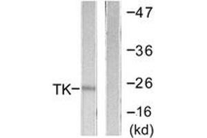 Western Blotting (WB) image for anti-Thymidine Kinase 1, Soluble (TK1) (AA 1-50) antibody (ABIN2888706)