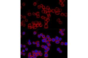 Immunofluorescence analysis of MCF7 cells using Caspase-1 Rabbit pAb (ABIN3021170, ABIN3021171, ABIN3021172 and ABIN6214049) at dilution of 1:150 (40x lens). (Caspase 1 Antikörper  (AA 1-311))