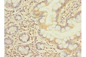 Immunohistochemistry of paraffin-embedded human small intestine tissue using ABIN7152386 at dilution of 1:100 (FCHSD2 Antikörper  (AA 1-290))