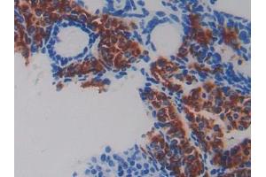 DAB staining on IHC-P; Samples: Mouse Ovary Tissue (Fibulin 5 Antikörper  (AA 170-243))