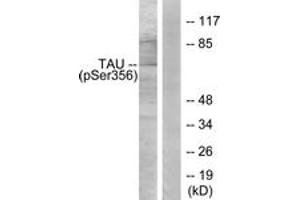 Western blot analysis of extracts from 293 cells treated with serum 10% 15', using Tau (Phospho-Ser356) Antibody. (tau Antikörper  (pSer673))