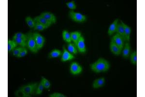 Immunofluorescence staining of HepG2 cells with ABIN7151491 at 1:133, counter-stained with DAPI.