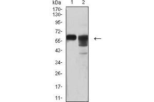 Western Blotting (WB) image for anti-CD46 (CD46) (AA 35-179) antibody (ABIN7193209)