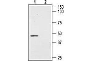 Western Blotting (WB) image for anti-Angiotensin II Receptor, Type 2 (AGTR2) (AA 21-35), (Extracellular) antibody (ABIN7042925)