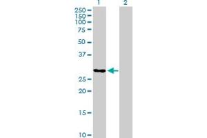 Western Blot analysis of TCEAL6 expression in transfected 293T cell line by TCEAL6 MaxPab polyclonal antibody. (TCEAL6 Antikörper  (AA 1-200))