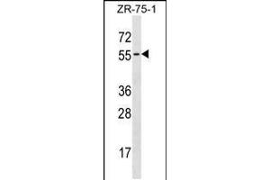 Western blot analysis in ZR-75-1 cell line lysates (35ug/lane). (TCN1 Antikörper  (C-Term))