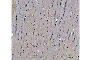 IHC analysis of TIGD1 using anti-TIGD1 antibody (ABIN7602407). (TIGD1 Antikörper  (AA 74-591))