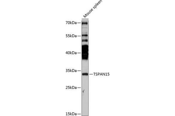 Tetraspanin 15 anticorps  (AA 110-220)