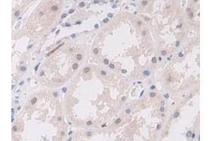 Immunohistochemistry (IHC) image for anti-E3 ubiquitin-protein ligase MIB2 (MIB2) (AA 687-930) antibody (ABIN7439483)