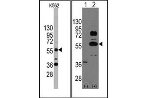 Image no. 1 for anti-SRY (Sex Determining Region Y)-Box 9 (SOX9) (N-Term) antibody (ABIN356879) (SOX9 Antikörper  (N-Term))