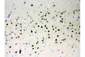 Anti- Parkin Picoband antibody, IHC(P) IHC(P): Rat Brain Tissue