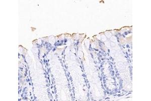 Immunohistochemistry analysis of paraffin-embedded mouse colon using,PLS1 (ABIN7075096) at dilution of 1: 2000 (PLS1 Antikörper)