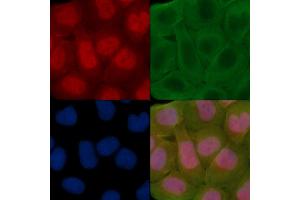 ABIN7095311 and ABIN7099368 staining Hela cells(30 min of UV treatment) by IF/ICC. (SOHLH2 Antikörper)