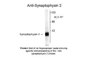 Western blot of Anti-Synaptophysin 2 (Rabbit) Antibody - 612-401-E36 Western Blot of Rabbit anti-Synaptophysin 2 antibody. (Synaptophysin 2 Antikörper  (C-Term))