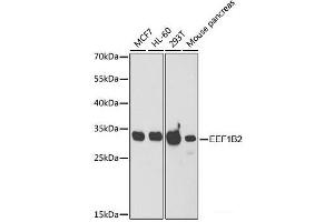 Western blot analysis of extracts of various cell lines using EEF1B2 Polyclonal Antibody at dilution of 1:1000. (EEF1B2 Antikörper)
