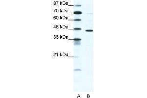 WB Suggested Anti-GABRP Antibody   Titration: 1. (GABRP Antikörper  (N-Term))