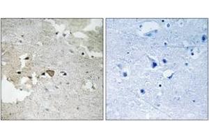 Immunohistochemistry analysis of paraffin-embedded human brain, using AXL (Phospho-Tyr691) Antibody. (AXL Antikörper  (pTyr691))