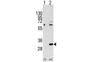 Image no. 2 for anti-Eukaryotic Translation Initiation Factor 4E Family Member 2 (EIF4E2) (N-Term) antibody (ABIN357298) (EIF4E2 Antikörper  (N-Term))