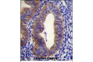 FGD6 Antibody (C-term) (ABIN655060 and ABIN2844689) immunohistochemistry analysis in formalin fixed and paraffin embedded human uterus tissue followed by peroxidase conjugation of the secondary antibody and DAB staining.