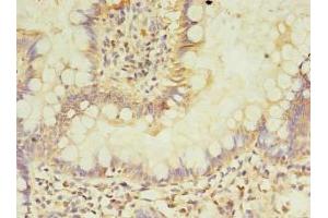 Immunohistochemistry of paraffin-embedded human small intestine tissue using ABIN7144191 at dilution of 1:100 (ASB6 Antikörper  (AA 1-197))