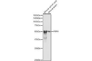 Western blot analysis of extracts of various cell lines, using PRPH antibody (ABIN1682318, ABIN3018463, ABIN3018464 and ABIN6220472) at 1:500 dilution. (Peripherin Antikörper  (AA 1-260))